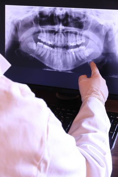 Best Emergency Treatment for Oral Infections in Taunton, MA